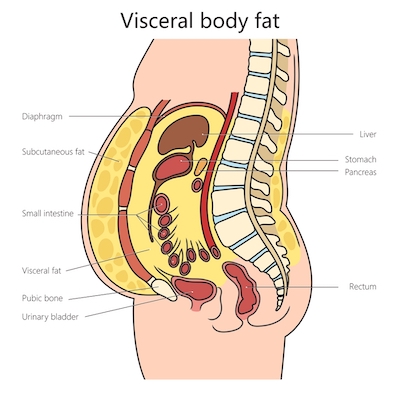 visceralbodyfat